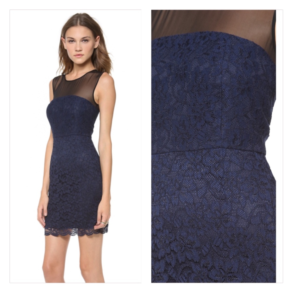 Diane von Furstenberg Nisha Lace Dress - Picture 2 of 8
